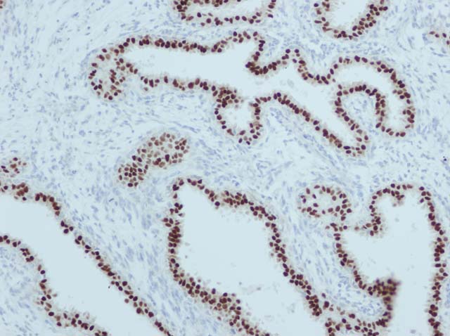 ihc-detection