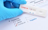 COVID-19 - Products for diagnosis - Rapid tests